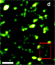 EGFP-tagged caveolin in a CHO cell imaged using 2PEFSTED